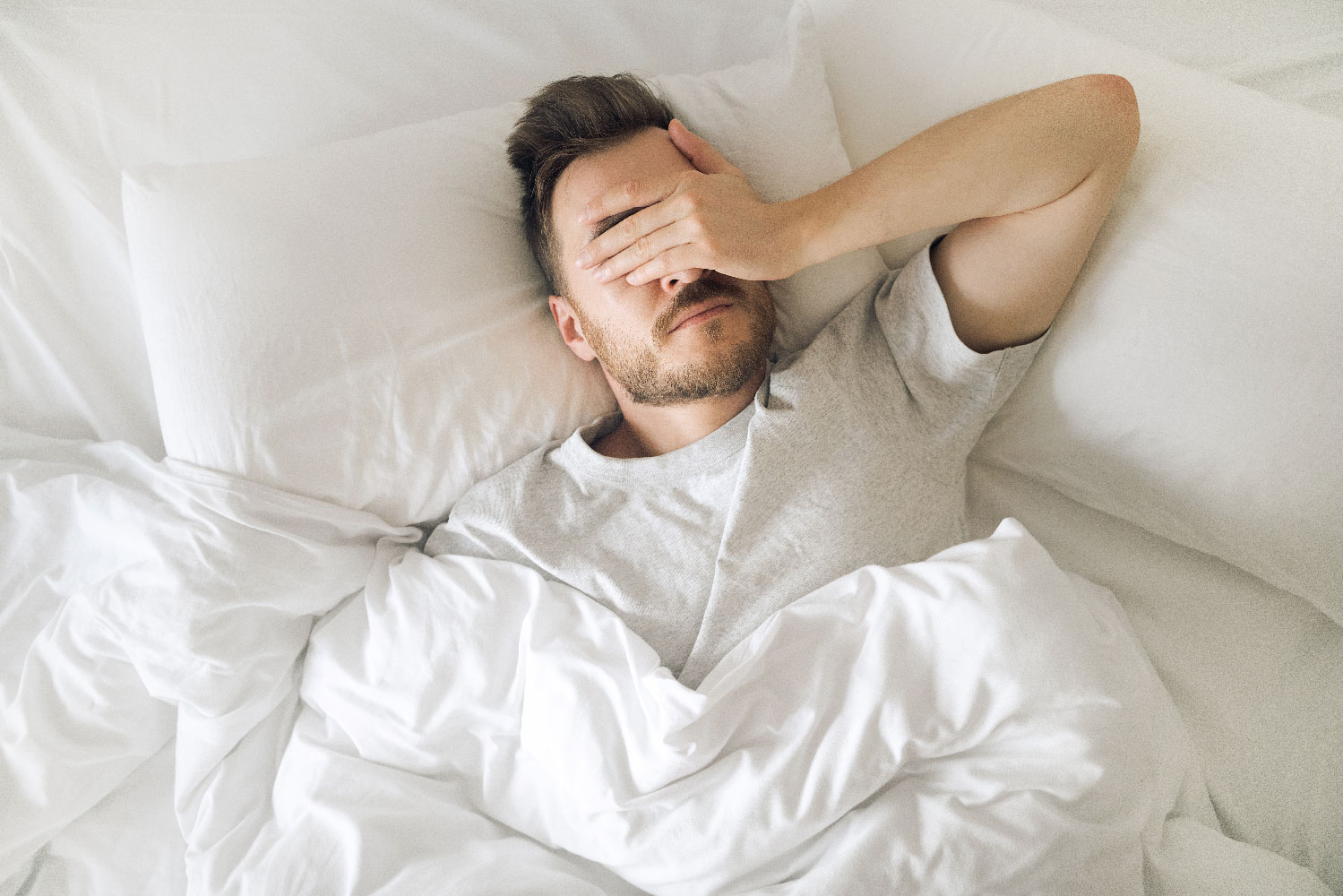 Mann im Tshirt liegt in einem weißen Bett auf dem Rücken und hält sich erschöpft die Hand über die Augen – Symbolbild für Schlafprobleme durch Schnarchen.